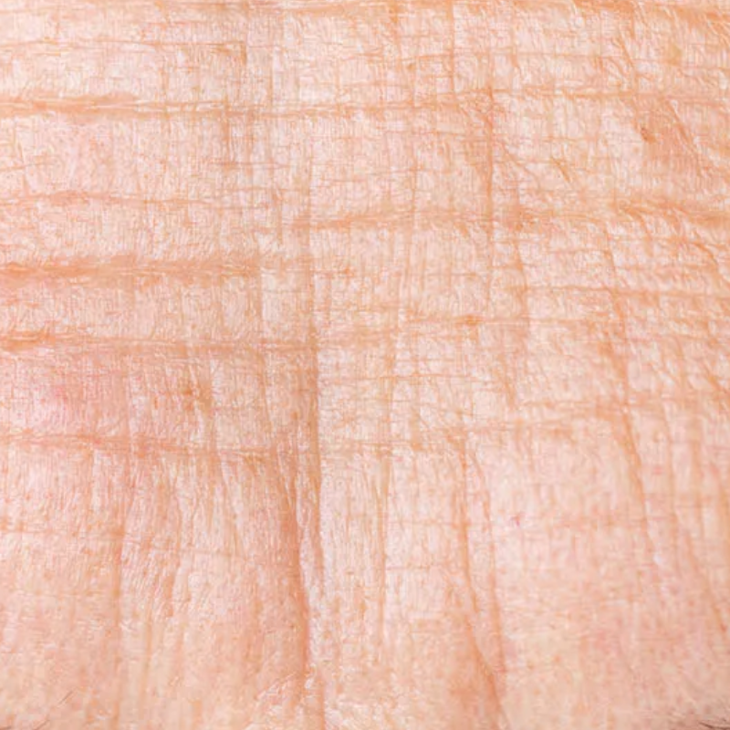 RIMPELS EN FIJNE LIJNTJES